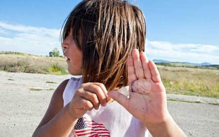 Sadie Time Sleeping (age 6) shows off her injured hand, Heart Butte, Blackfeet Reservation, Montana